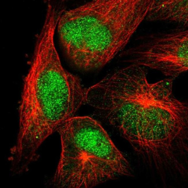 POLM Antibody in Immunocytochemistry (ICC/IF)