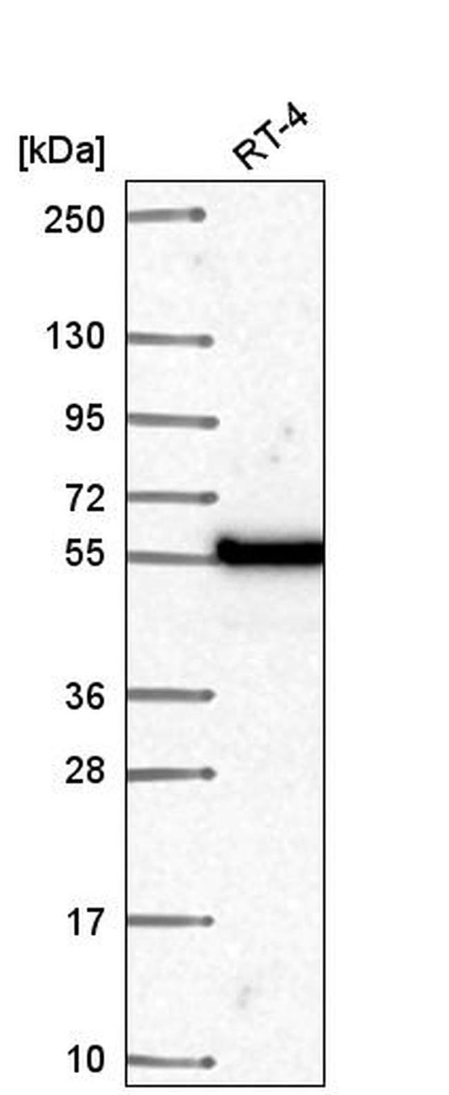 POLM Antibody in Western Blot (WB)