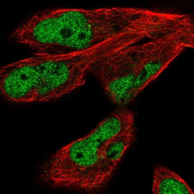 JMJD1C Antibody in Immunocytochemistry (ICC/IF)