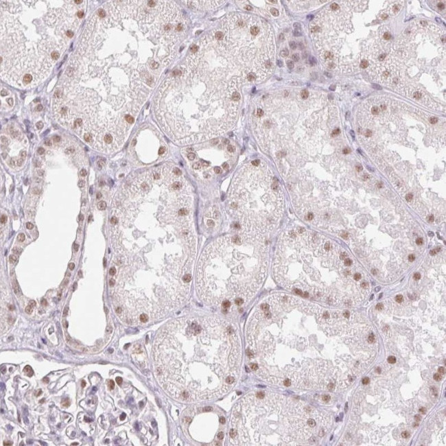 RPRD1B Antibody in Immunohistochemistry (IHC)