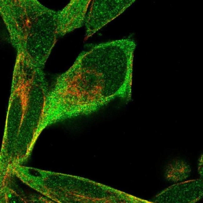 RPRD1B Antibody in Immunocytochemistry (ICC/IF)