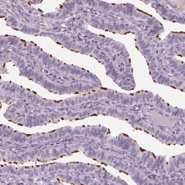 PACRG Antibody in Immunohistochemistry (IHC)