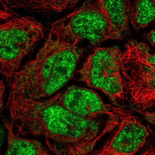 CDK5RAP1 Antibody in Immunocytochemistry (ICC/IF)