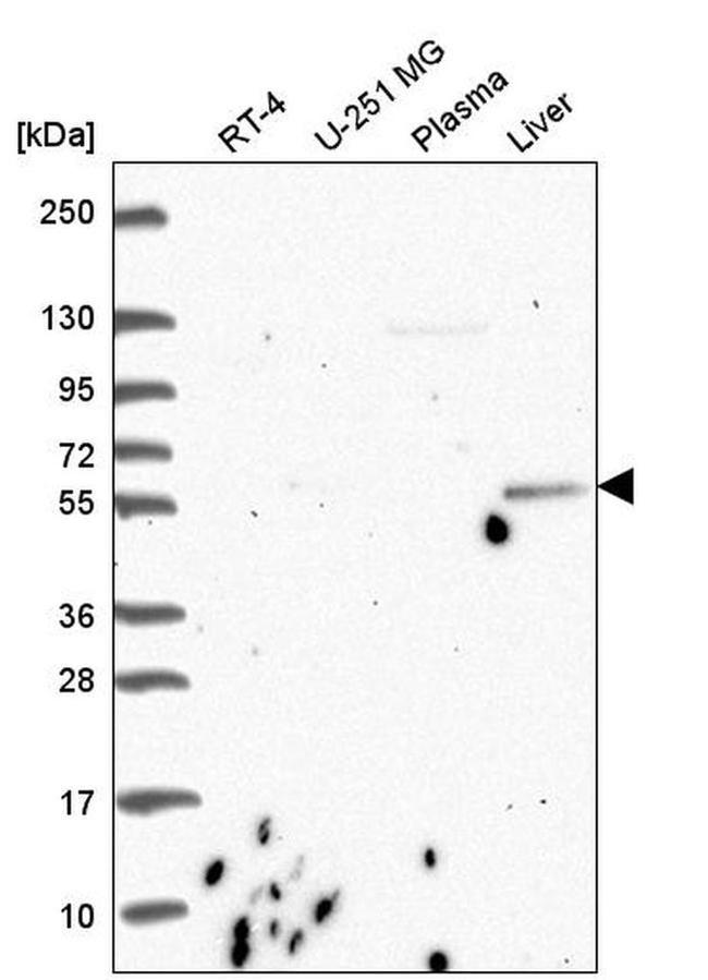 CDK5RAP1 Antibody in Western Blot (WB)