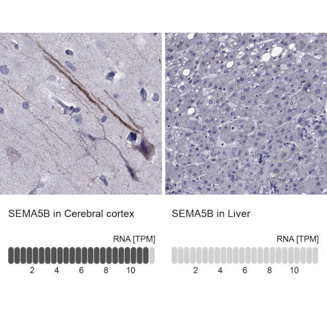 SEMA5B Antibody in Immunohistochemistry (IHC)