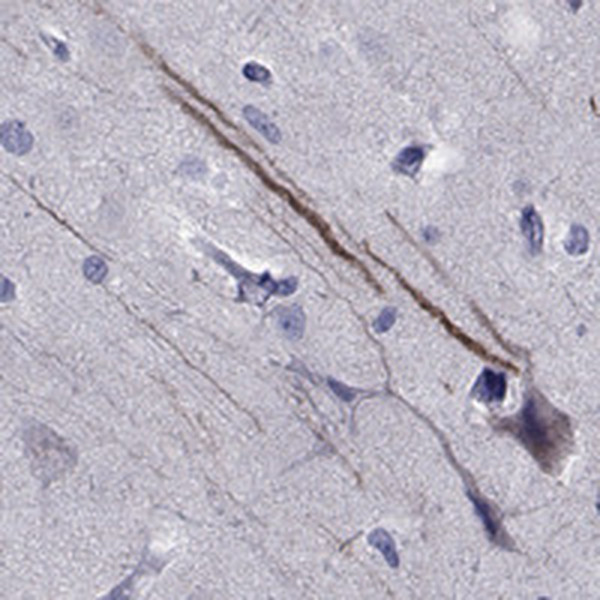 SEMA5B Antibody in Immunohistochemistry (IHC)