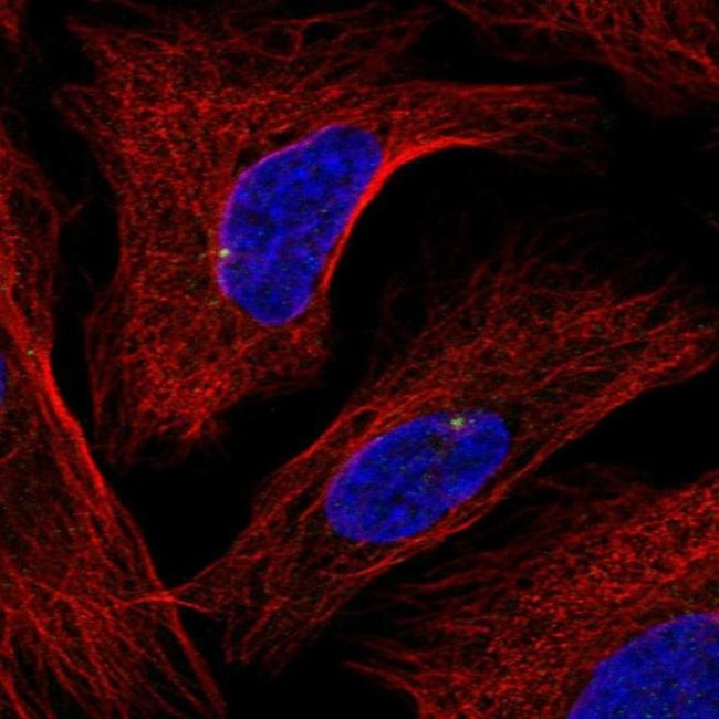 GRAP Antibody in Immunocytochemistry (ICC/IF)