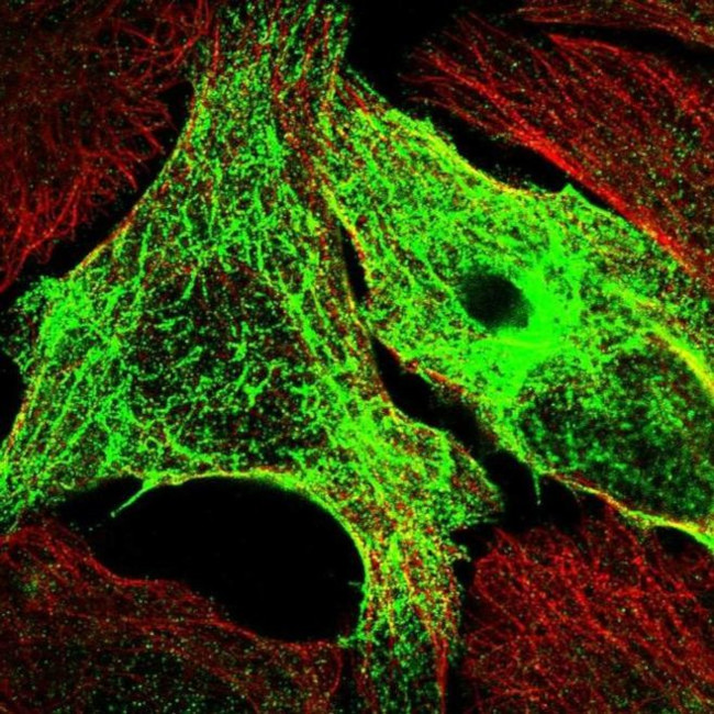 SYCE1L Antibody in Immunocytochemistry (ICC/IF)