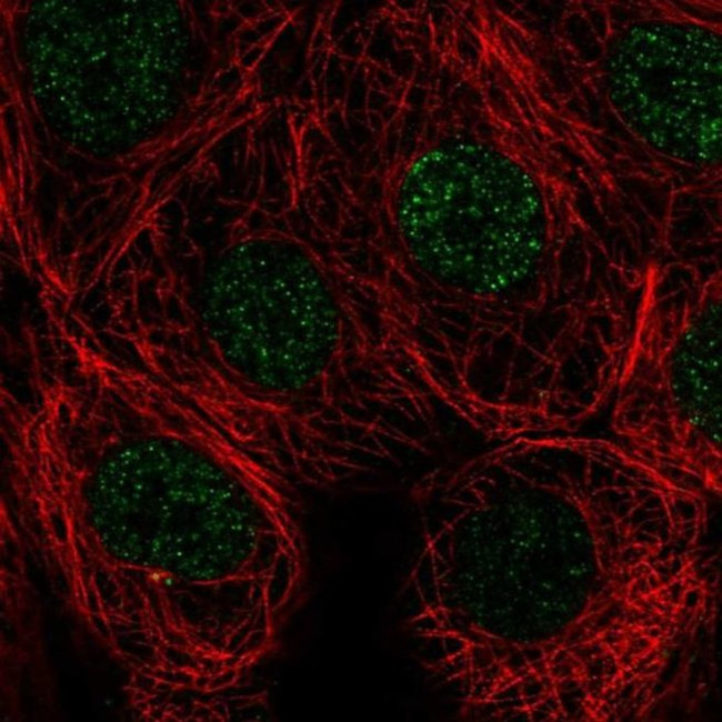 SIVA1 Antibody in Immunocytochemistry (ICC/IF)