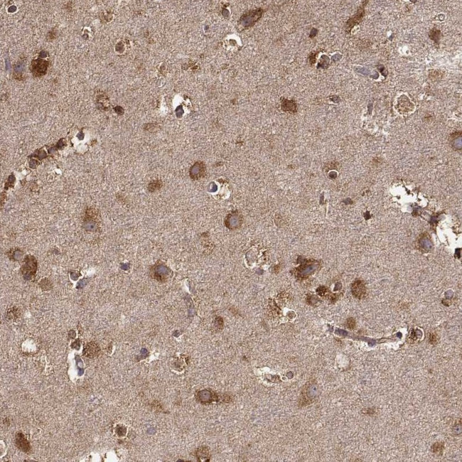 TARSL2 Antibody in Immunohistochemistry (IHC)