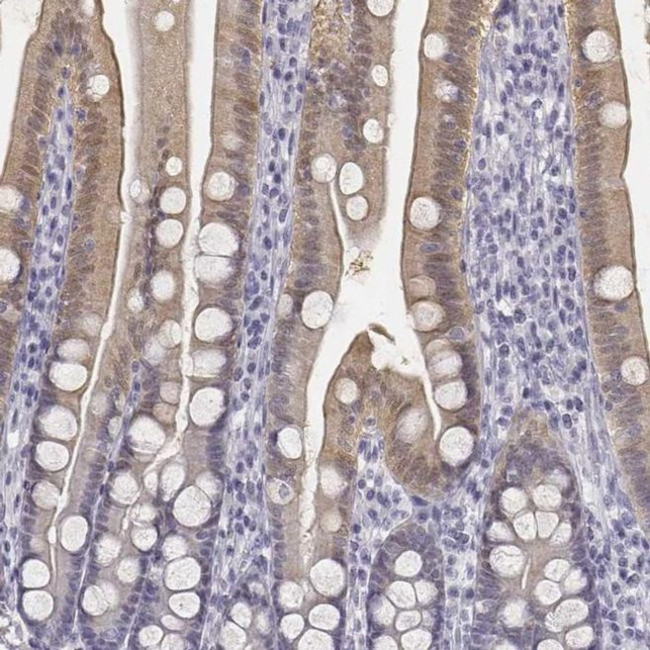 UCN2 Antibody in Immunohistochemistry (IHC)