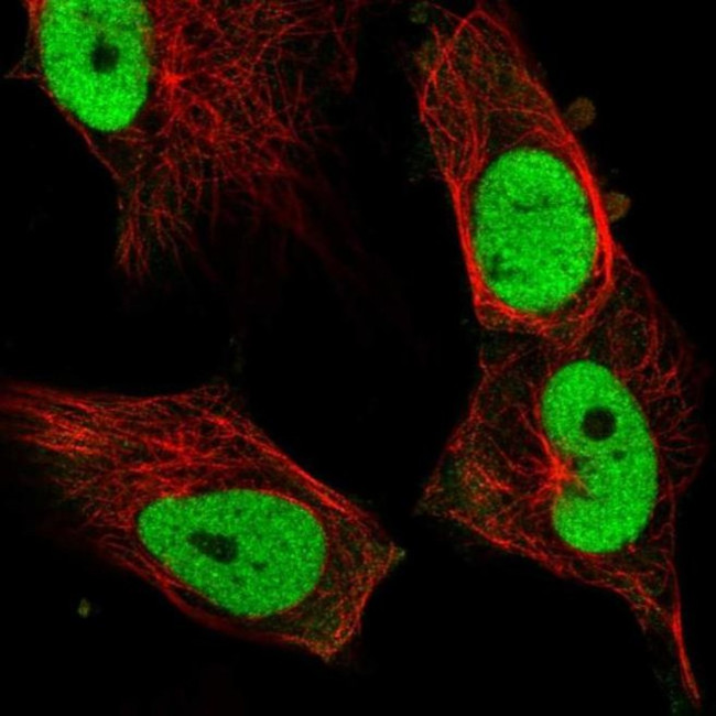 Fra1 Antibody in Immunocytochemistry (ICC/IF)