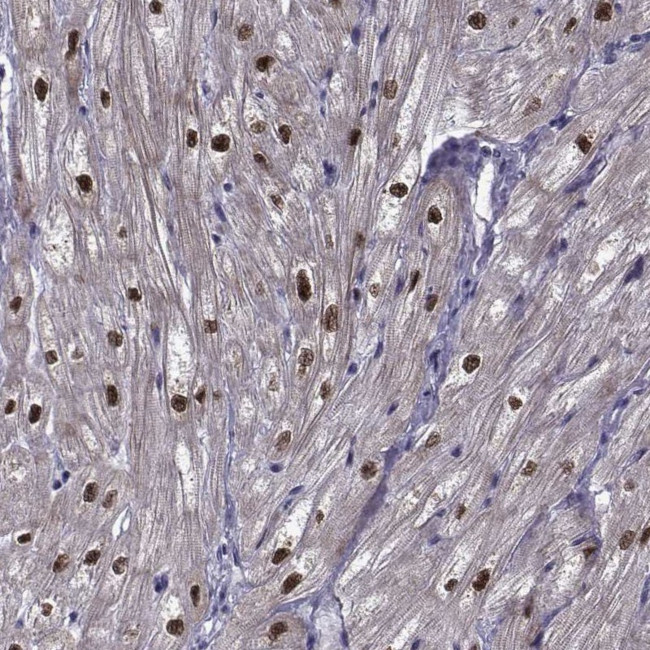 RBM24 Antibody in Immunohistochemistry (IHC)