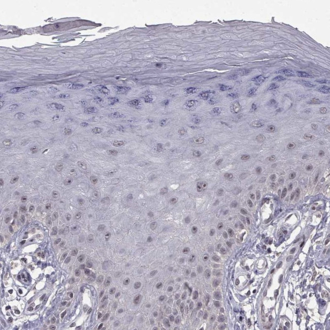 RBM24 Antibody in Immunohistochemistry (IHC)