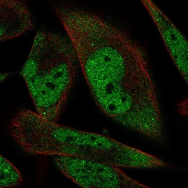 RBM24 Antibody in Immunocytochemistry (ICC/IF)