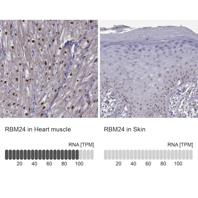 RBM24 Antibody