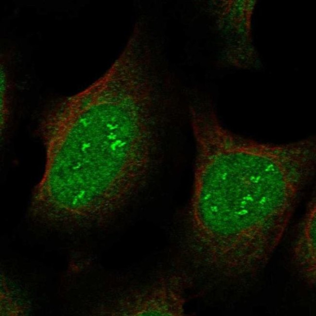 JAZF1 Antibody in Immunocytochemistry (ICC/IF)