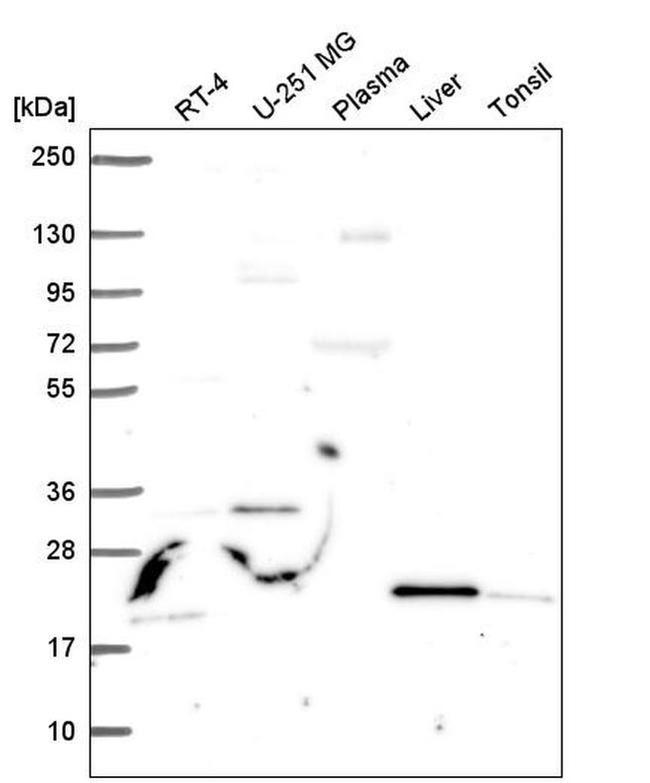 JAZF1 Antibody in Western Blot (WB)