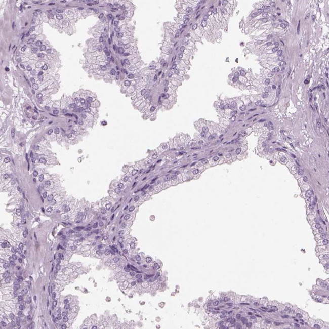 HYDIN Antibody in Immunohistochemistry (IHC)