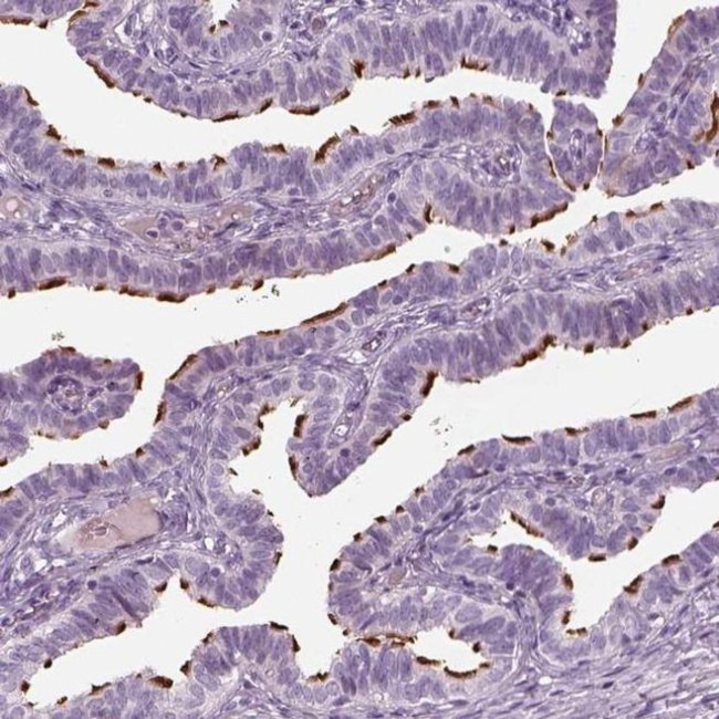 HYDIN Antibody in Immunohistochemistry (IHC)