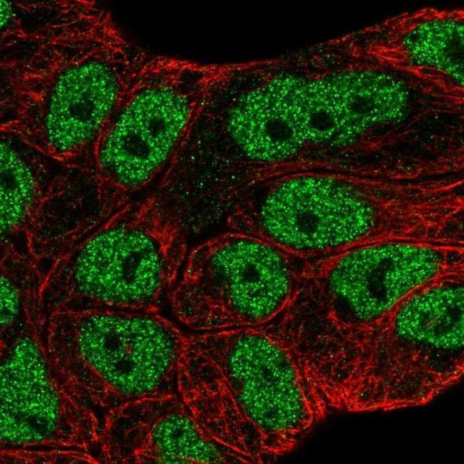 ABCA6 Antibody in Immunocytochemistry (ICC/IF)