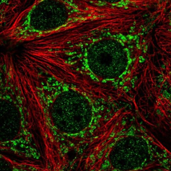 ATP5J2 Antibody in Immunocytochemistry (ICC/IF)