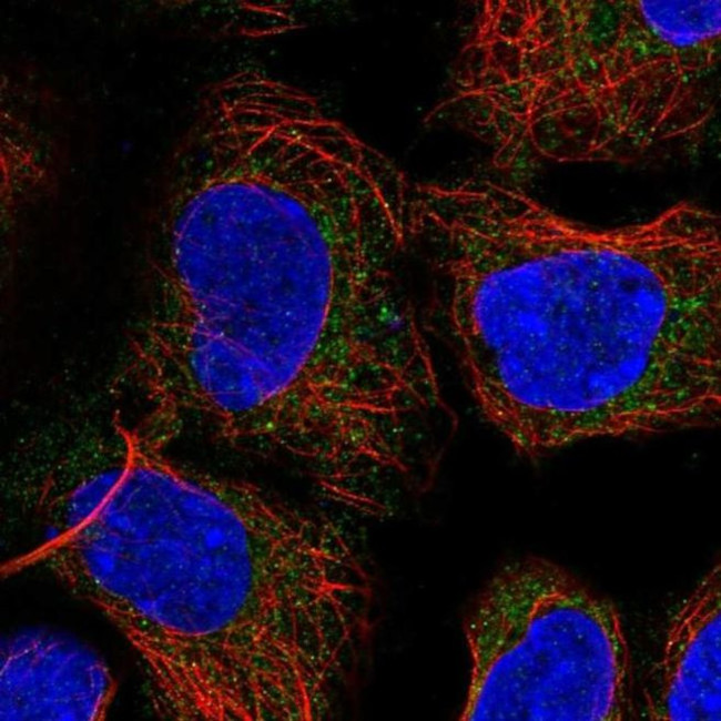 PICK1 Antibody in Immunocytochemistry (ICC/IF)