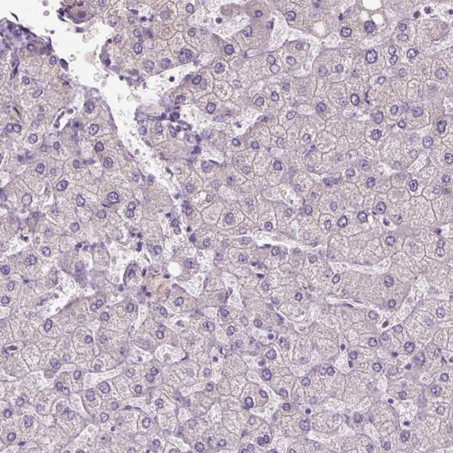 IFT52 Antibody in Immunohistochemistry (IHC)