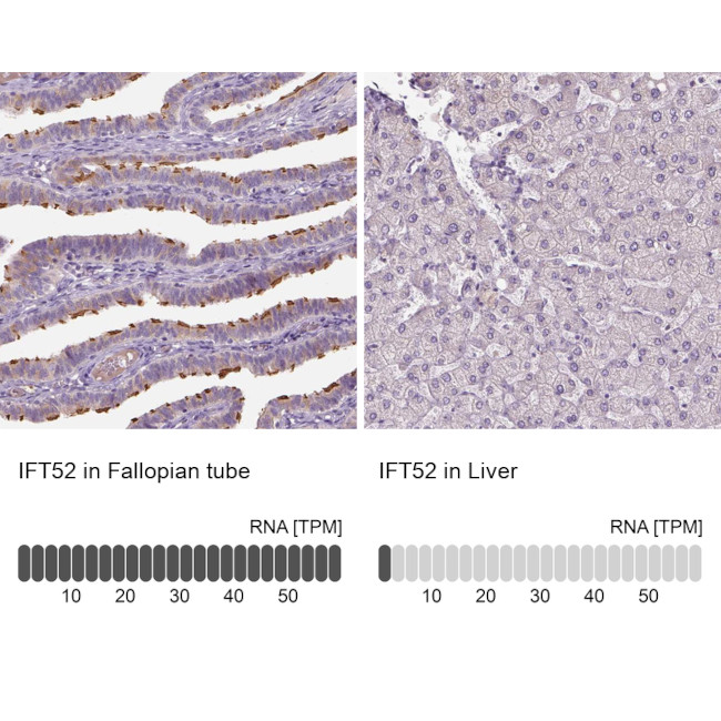 IFT52 Antibody