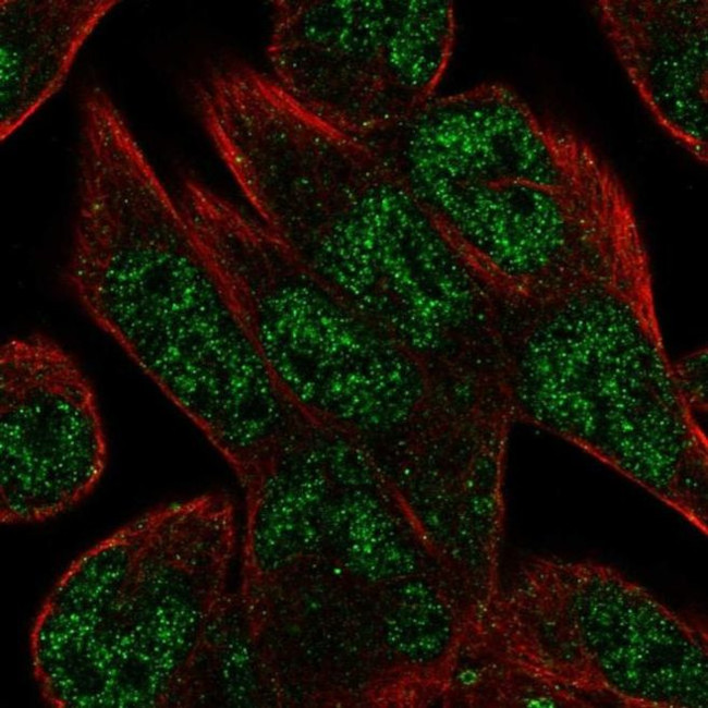 C16orf72 Antibody in Immunocytochemistry (ICC/IF)