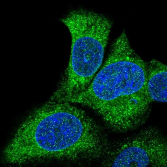 SLC27A3 Antibody in Immunocytochemistry (ICC/IF)