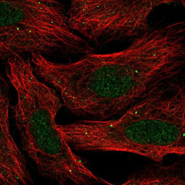 SLC30A3 Antibody in Immunocytochemistry (ICC/IF)