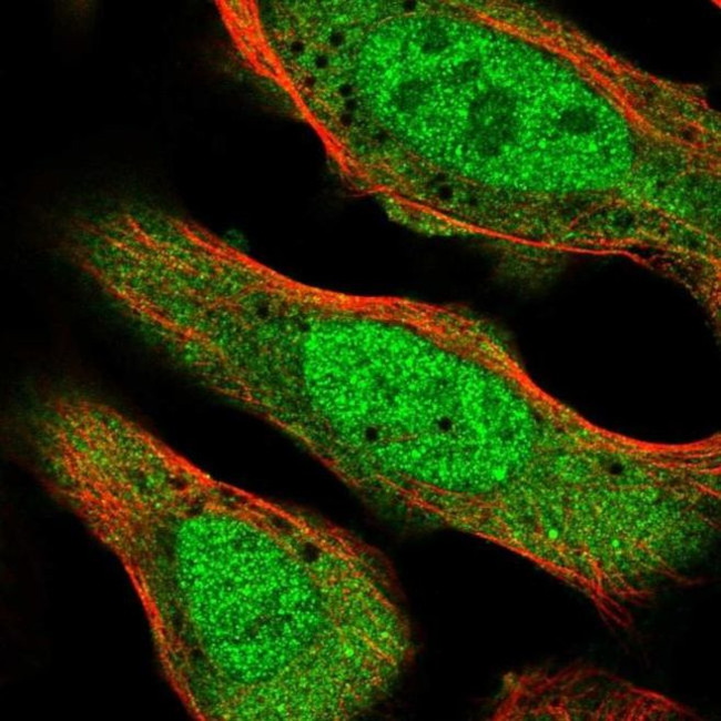 CNOT2 Antibody in Immunocytochemistry (ICC/IF)