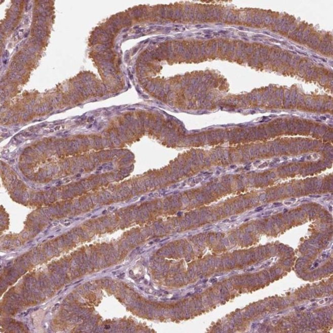 CNOT2 Antibody in Immunohistochemistry (IHC)