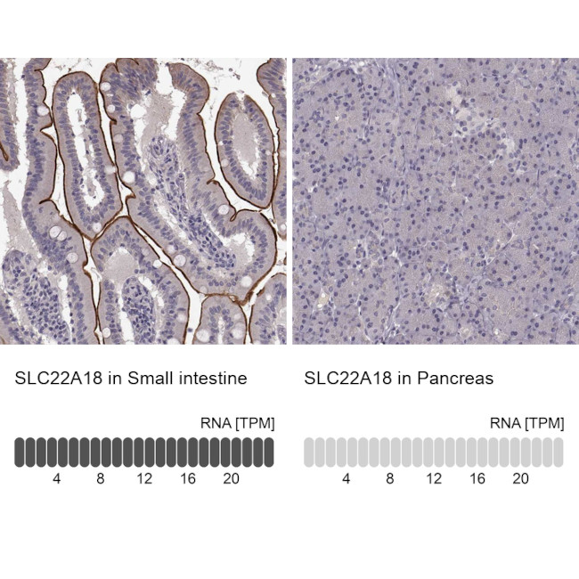 SLC22A18 Antibody