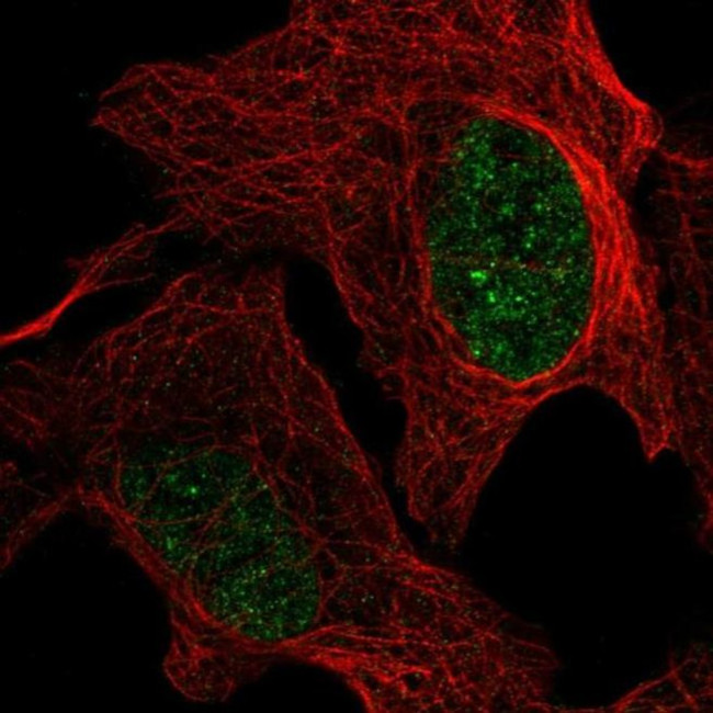 GMPR2 Antibody in Immunocytochemistry (ICC/IF)