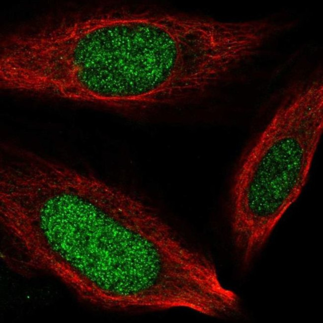 NCAPH2 Antibody in Immunocytochemistry (ICC/IF)