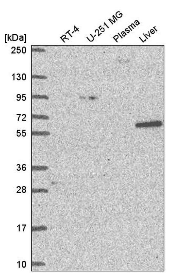 NCAPH2 Antibody in Western Blot (WB)