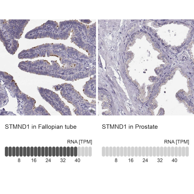 STMND1 Antibody in Immunohistochemistry (IHC)