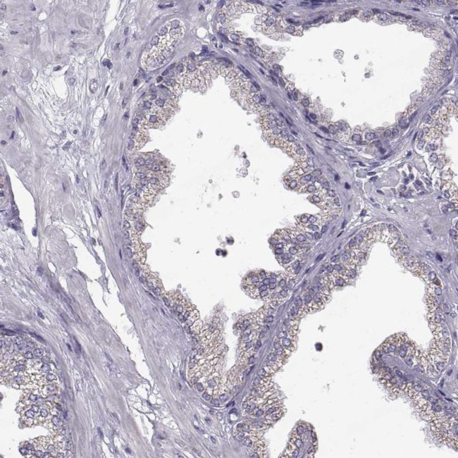 STMND1 Antibody in Immunohistochemistry (IHC)