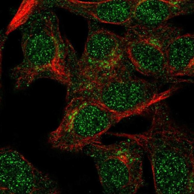 VPS54 Antibody in Immunocytochemistry (ICC/IF)