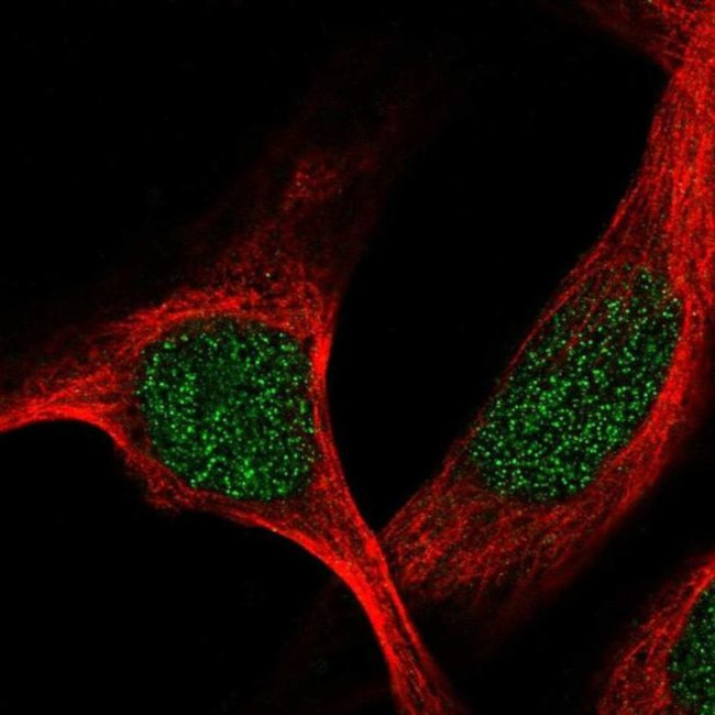 TBRG1 Antibody in Immunocytochemistry (ICC/IF)