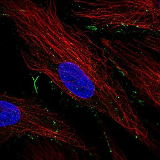 TBC1D24 Antibody in Immunocytochemistry (ICC/IF)