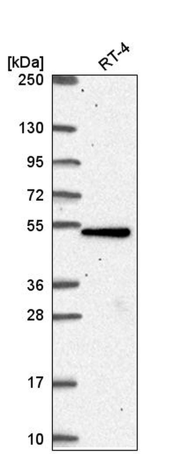 TBC1D24 Antibody in Western Blot (WB)