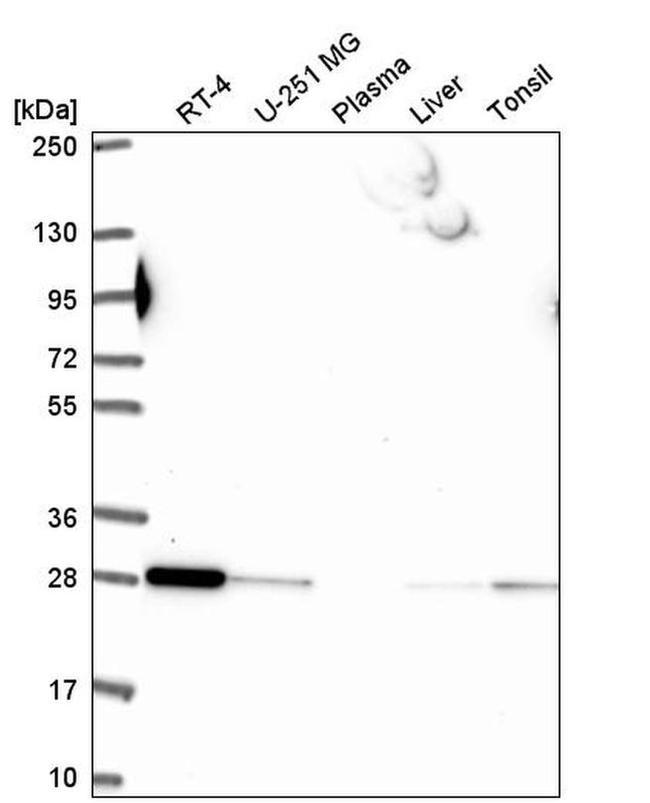 RAB5B Antibody in Western Blot (WB)