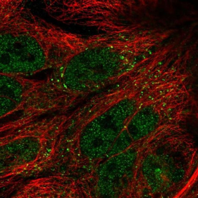 TTI1 Antibody in Immunocytochemistry (ICC/IF)