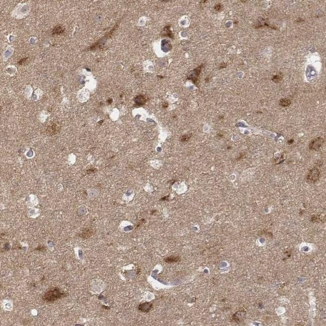 beta-1 Adaptin Antibody in Immunohistochemistry (IHC)