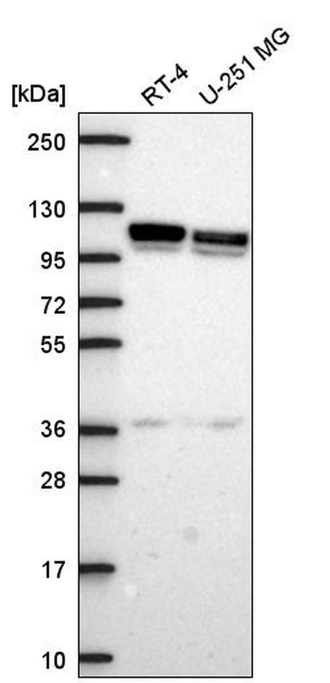 beta-1 Adaptin Antibody in Western Blot (WB)