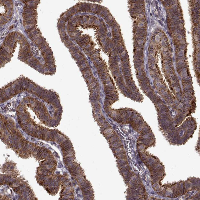 IFRD2 Antibody in Immunohistochemistry (IHC)