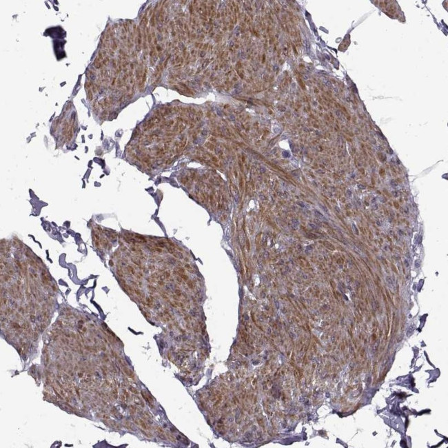 SYNPO2 Antibody in Immunohistochemistry (IHC)